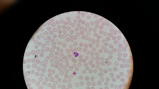 Blood Slides - Blood 003 400X